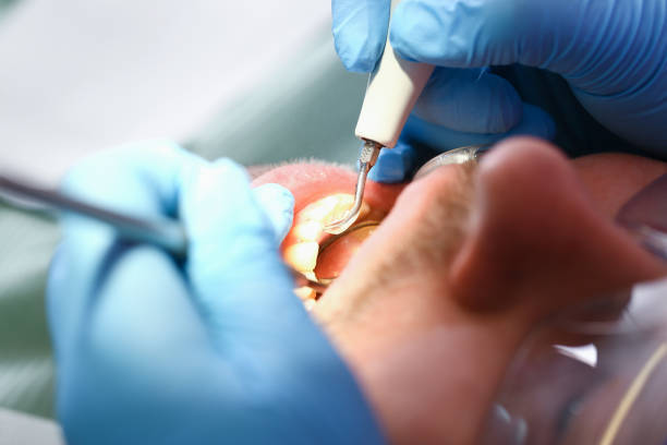 Best Emergency Gum Treatment in Frazee, MN