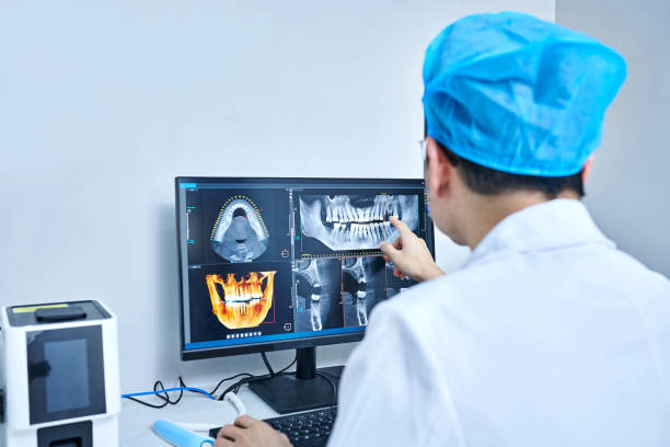 Best Emergency Tooth Extraction in Frazee, MN