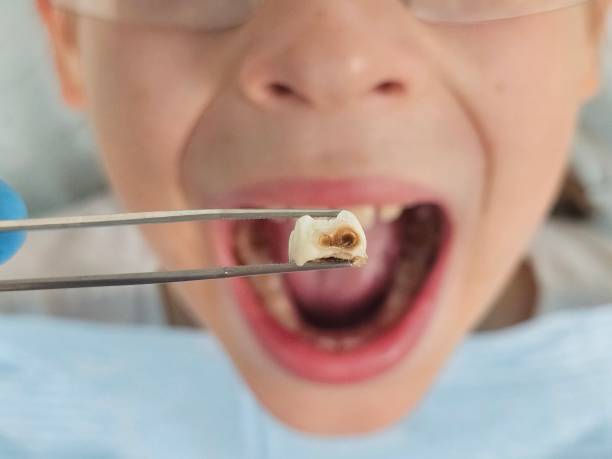 Best Pediatric Emergency Dentist in Frazee, MN